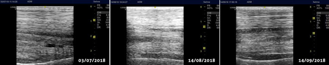 Treating a torn tendon in horses with laser therapy Treating a torn tendon in horses with laser therapy